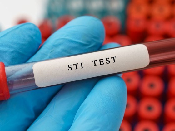 sti test3